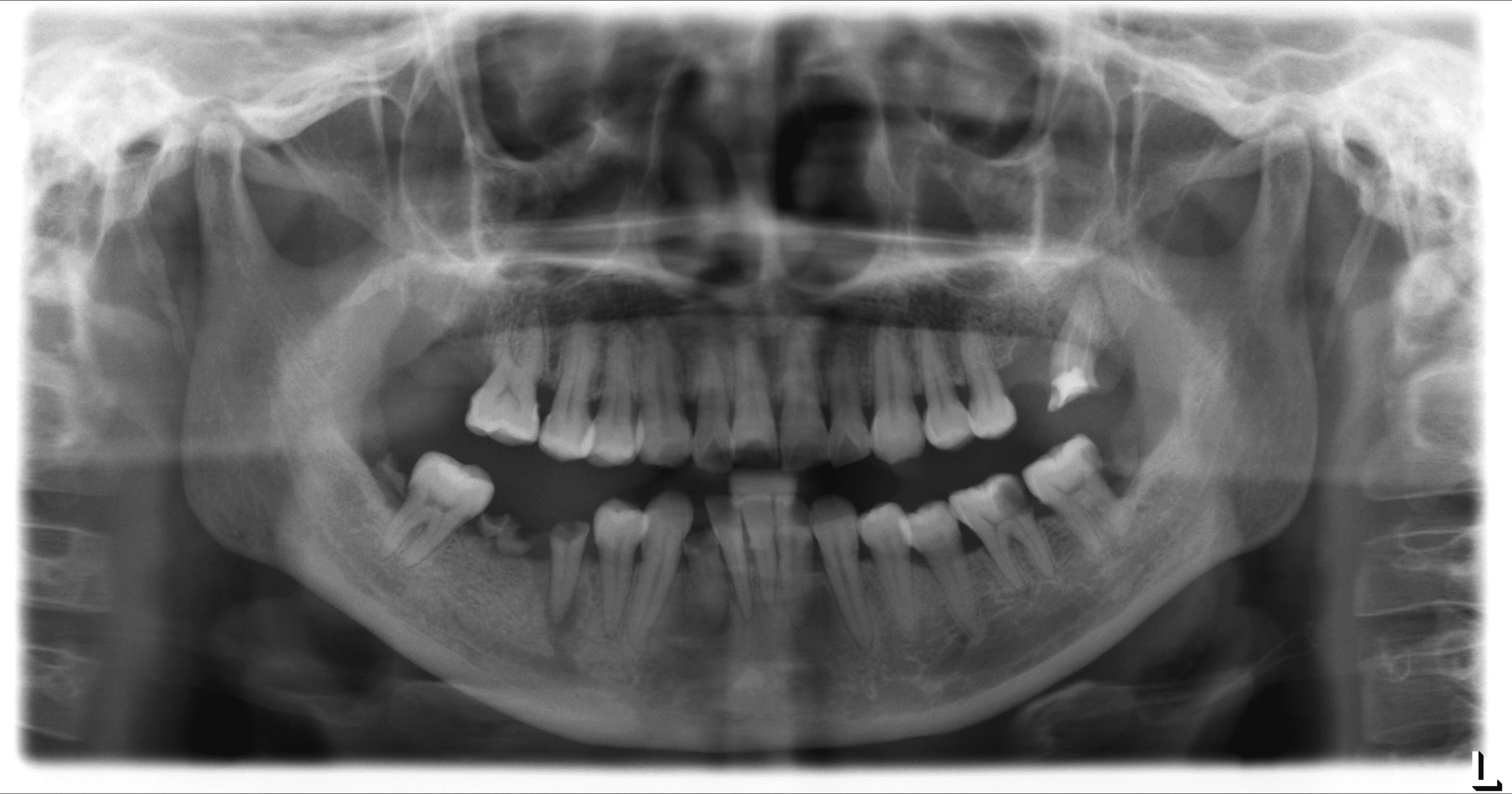 Dashboard d'imagerie — vue brute